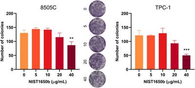 Acute exposure to diesel particulate matter promotes collective cell migration in thyroid cancer cells